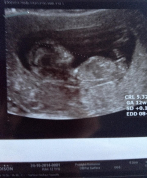 ecdd007f9808c1d3med.jpg
