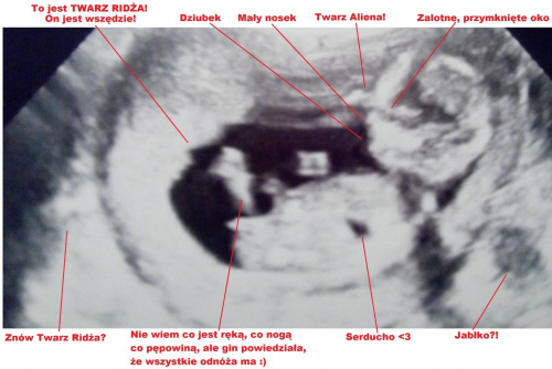 8fbf7e8a025a6db1med.jpg