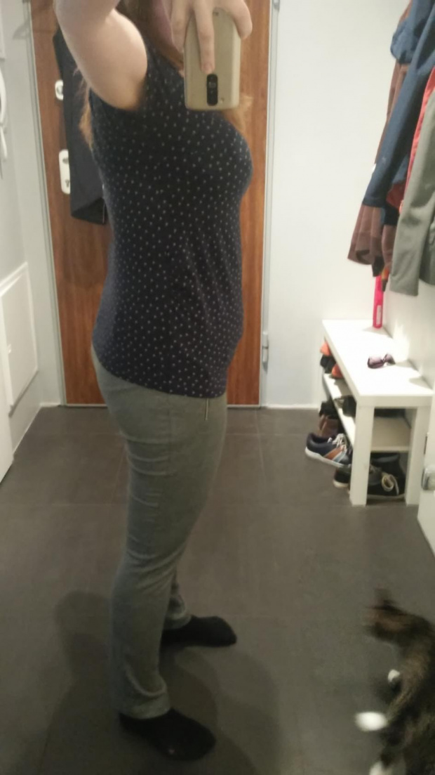 19t1d